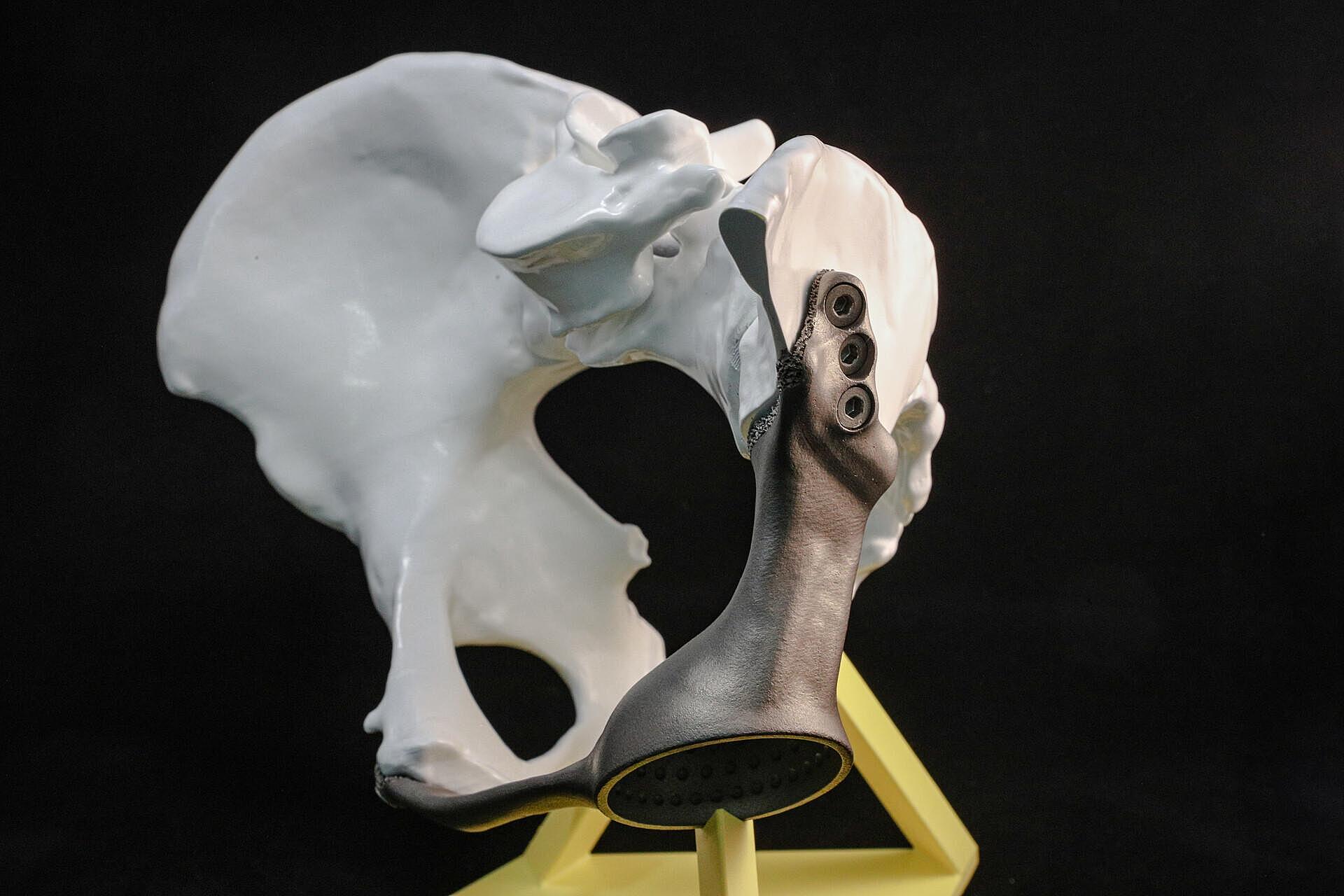 Время киборгов: как технологии 3D-печати меняют жизнь людей и животных