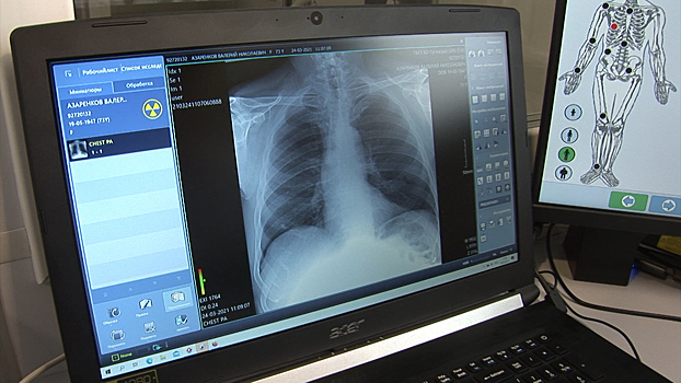 Всемирный день борьбы с туберкулёзом: как в регионе работают передвижные рентген-кабинеты
