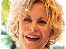 Знаменитости, карьеру которых погубила страсть к пластическим операциям