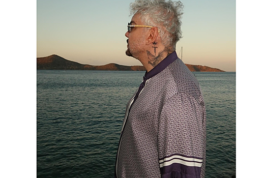 Филипп Киркоров случайно «засветил» все еще не заживший ожог на руке