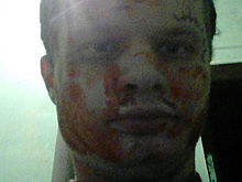 Российский поэт-каннибал выел знакомой мозг на 8 Марта