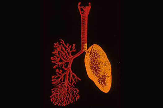 Врачи предположили, что плесень — виновник легочного заболевания