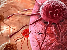 Онколог предупредил курящих с лишним весом об опасности рака