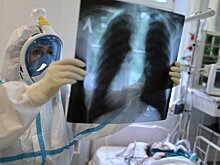 Вирусолог предупредил о всплеске COVID-19 в РФ в начале 2023 года