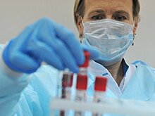 Главный специалист Минздрава назвал число людей с ВИЧ в России