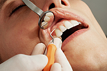 Стоматолог перечислила нетипичные симптомы зубной боли