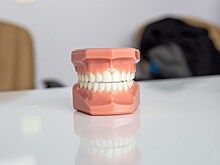 Стоматолог предупредил о негативных последствиях неправильного прикуса