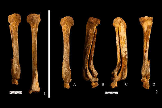 Ученые обнаружили древнюю китаянку, которой в наказание отрезали ногу