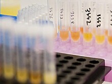 Олимпийская чемпионка Нагейкина поделилась мнением о проблеме допинга в России