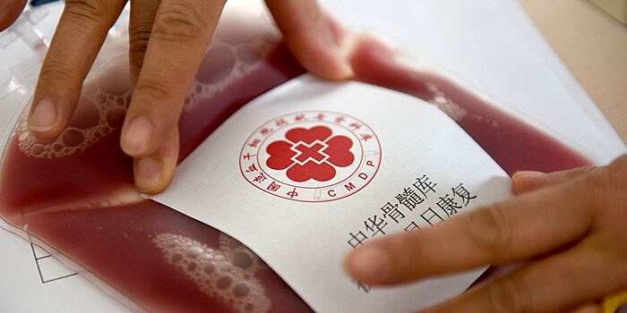 Стволовые клетки из донорской крови, пожертвованной студентом из Хэфэя, помогут пациенту в провинции Сычуань