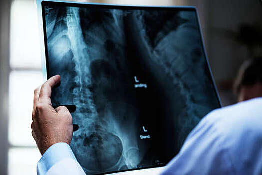 В больницах Подмосковья установили около 50 рентген-аппаратов с начала года