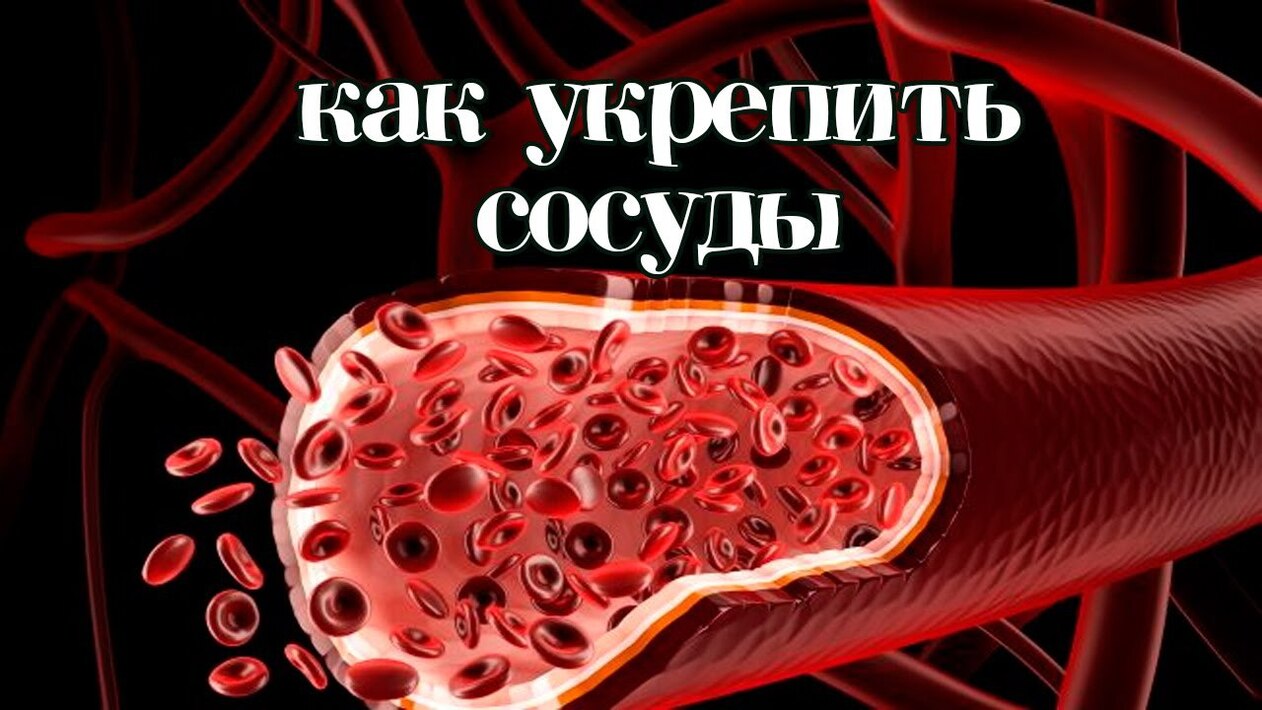 для укрепления сосудов. как восстановить сосуды. продукты для укрепления сосудов и вен. травы для улучшения кровообращения. как восстановить сосуды.