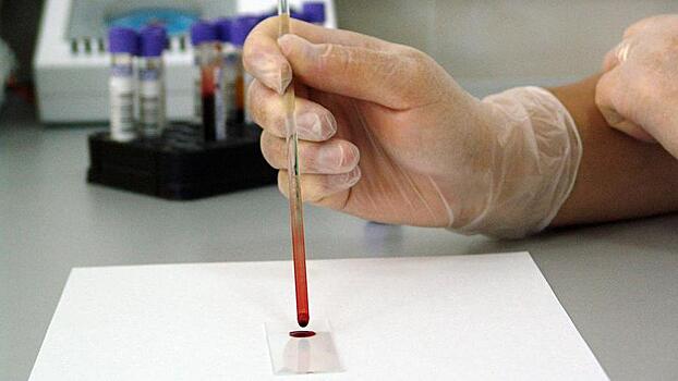 Более 1,3 млн жителей Подмосковья сдали анализ на ВИЧ в январе-сентябре