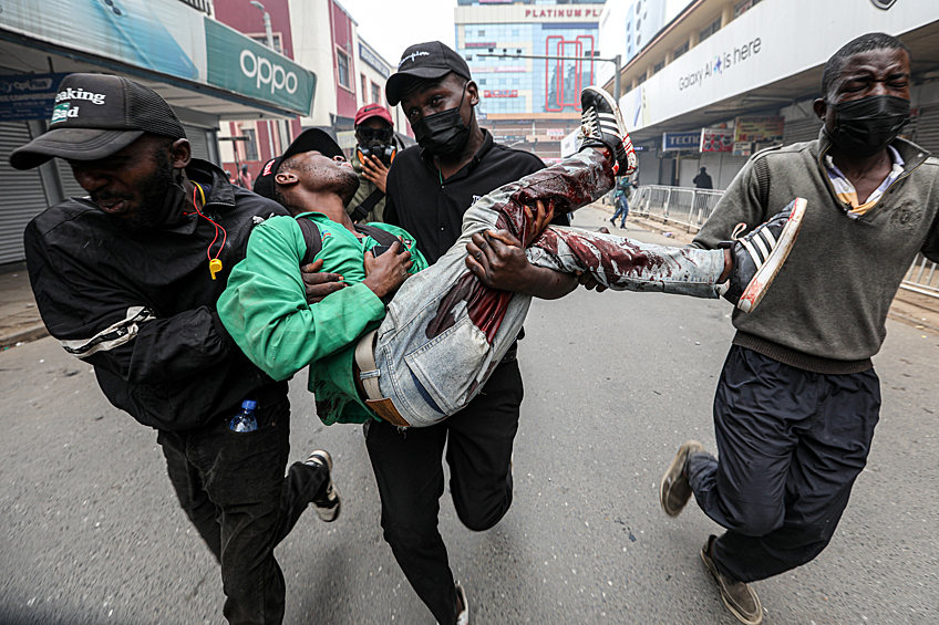 Один из пострадавших в стычке с полицей в Найроби, 2 июля 2024 года
