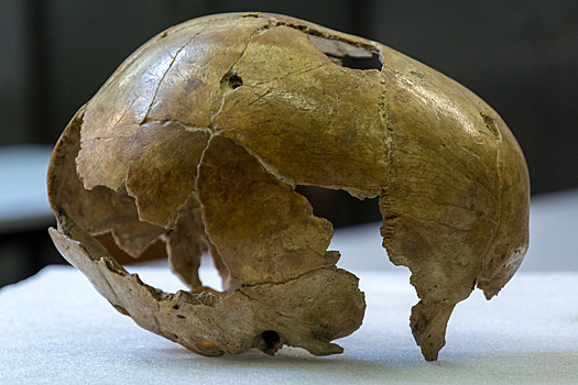 В наших головных болях виноватыми оказались доисторические предки