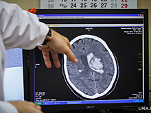 Коронавирус способен разрушить ткани головного мозга
