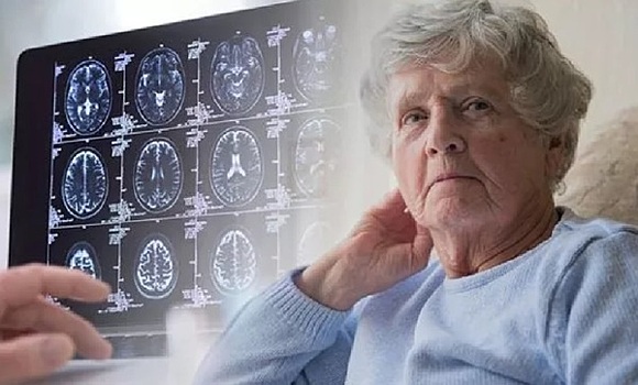 Врачи назвали три ключевых отличия деменции от обычных возрастных проблем с памятью