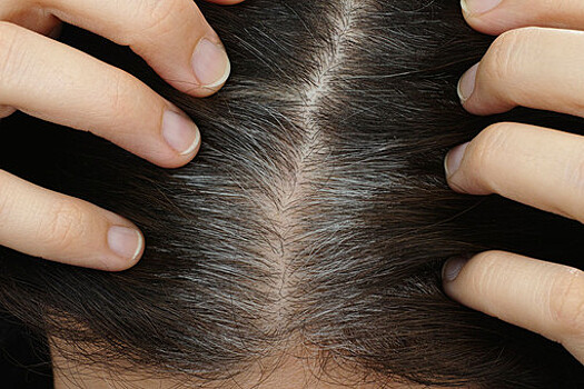 Трихолог Фролова: ранняя седина – это повод пройти медицинское обследование