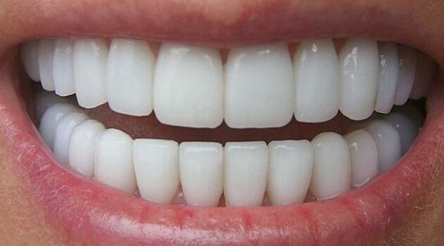 Ученые доказали влияние здоровья зубов на общее самочувствие