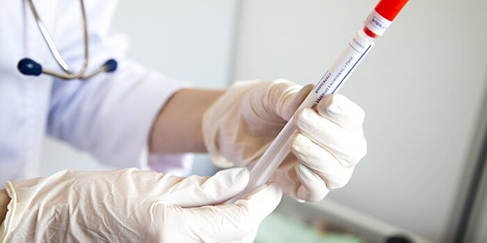 Испытания казахстанской COVID-вакцины на грызунах исключили токсичность препарата
