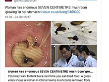 Из желудка женщины извлекли 7-сантиметровые грибы