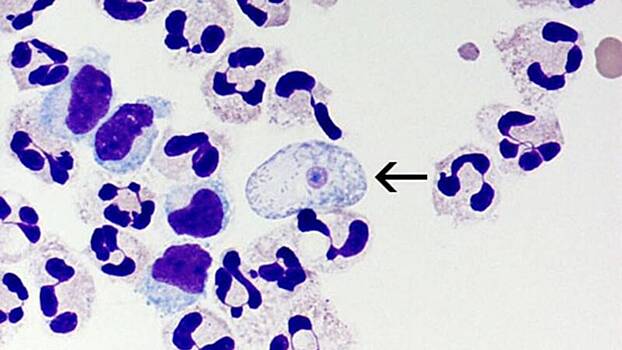 Что известно об амебе-«мозгоеде» и как она попадает в организм