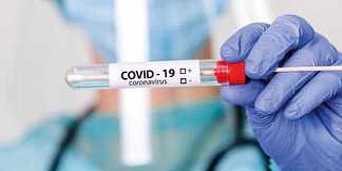 За новогодние каникулы в Вологодской области  было проведено 20 493 теста на новую коронавирусную инфекцию