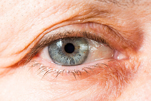 Медики объяснили, почему дети чаще стали страдать от синдрома сухого глаза
