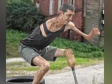 «Доедают клопы»: новые мучения заключенного без рук, ноги и уха