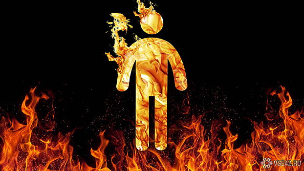 В Омске скончалась женщина с почти полностью обожженным телом