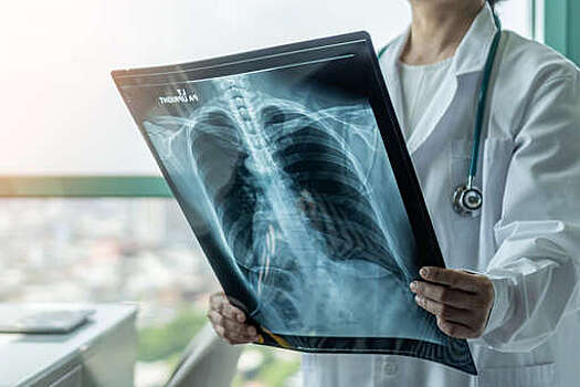 В больницах Подмосковья заработали еще 3 рентгеновских аппарата и маммограф