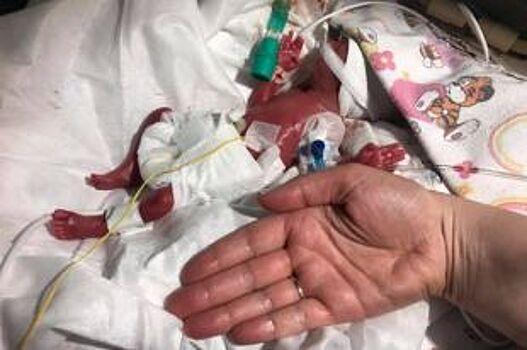 Красноярские врачи продолжают бороться за жизнь 500-граммового младенца
