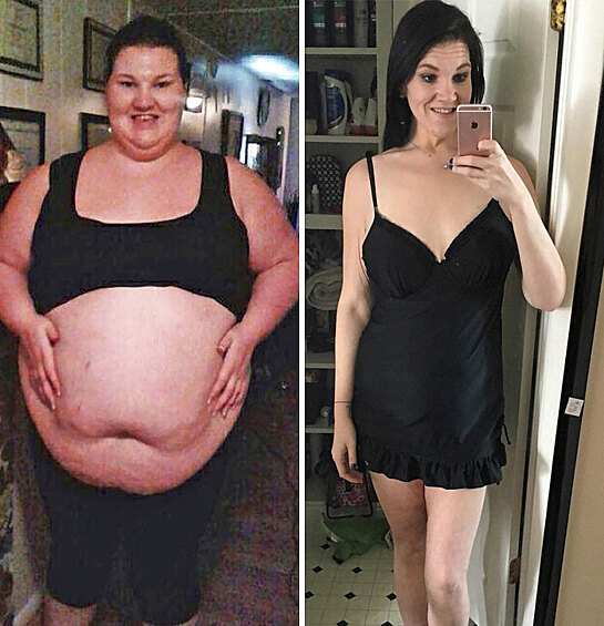 Женщина весила 187 кг и каждый день съедала восемь порций в «Макдоналдсе». После микроинсульта она похудела на 108 кг.