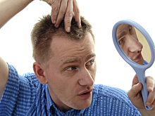 Низкорослые мужчины раньше лысеют