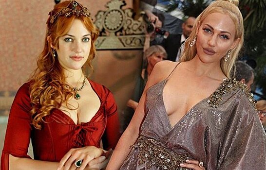 Мерьем Узерли и другие турецкие актрисы, которым пластика пошла не на пользу