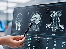 Названы питательные вещества, замедляющие старение мозга