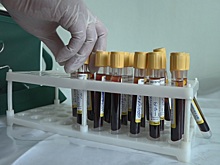 Проверить здоровье и предупредить опасные заболевания. Акция «Онкопатруль» прошла в Балашихе