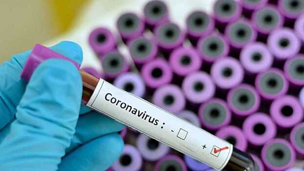 Москвичам дали рекомендации для профилактики коронавируса