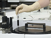 Врачи назвали три причины развития хронической болезни почек