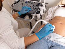 Россиянок раскритиковали за «размножение за деньги»