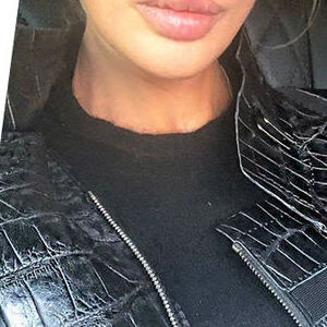 Пластические операции звезд: фото до и после