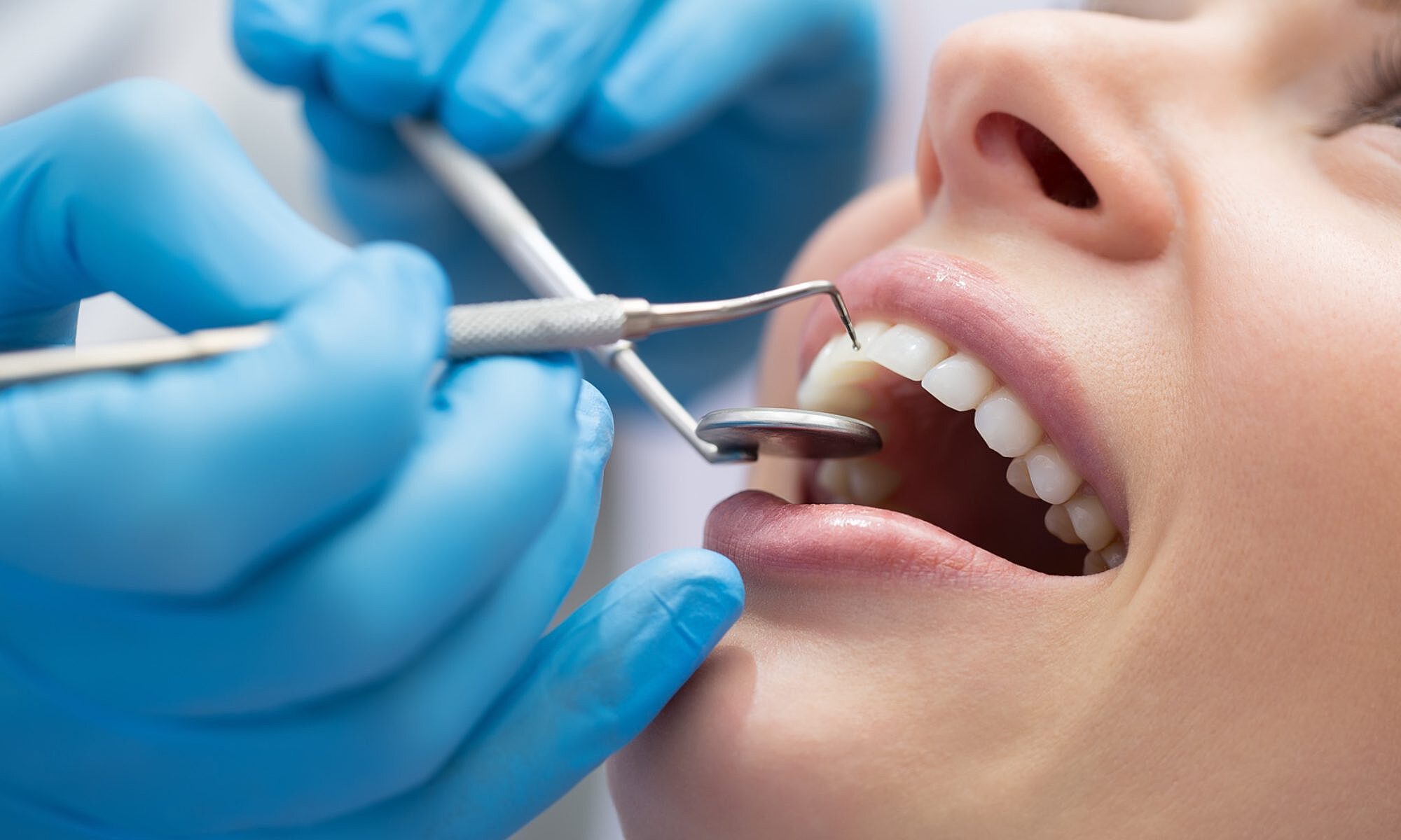 Названы пять ненужных стоматологических процедур
