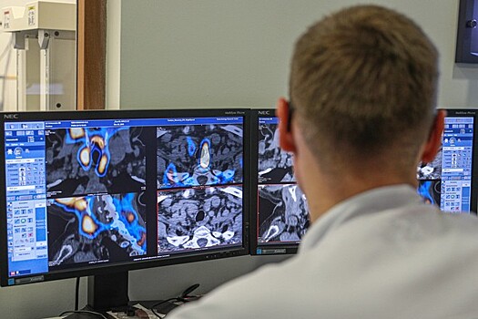 Российские учёные разработали метод диагностики рака груди при помощи ИИ