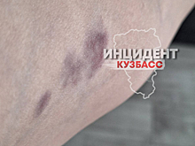 Юные драчуны избили супругов в Кемерове