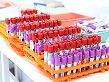 Почему развивается анемия и как предотвратить это заболевание