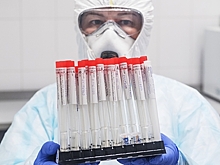 Названа причина большого числа молодежи с COVID-19