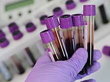 В Югре за сутки коронавирусом заразились 2,4 тысячи человек