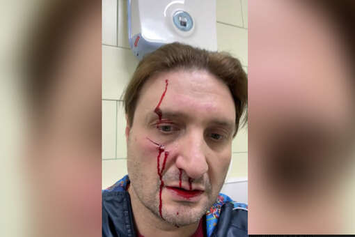 Эдгард Запашный госпитализирован после удара тигра