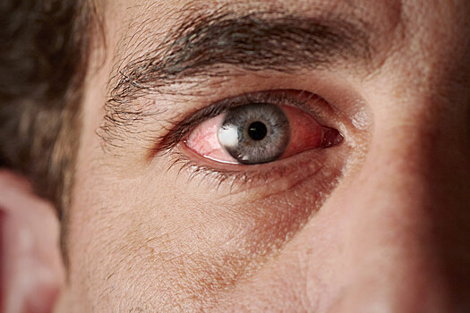 Найден способ определить скорость старения по сосудам в глазах