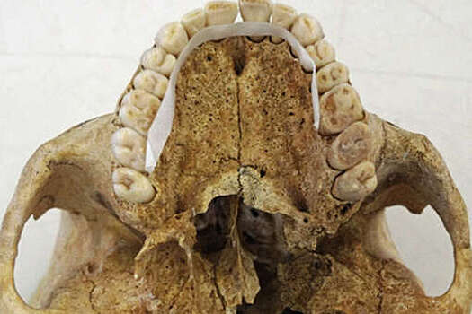 Обнаружены кости больного проказой средневекового британца